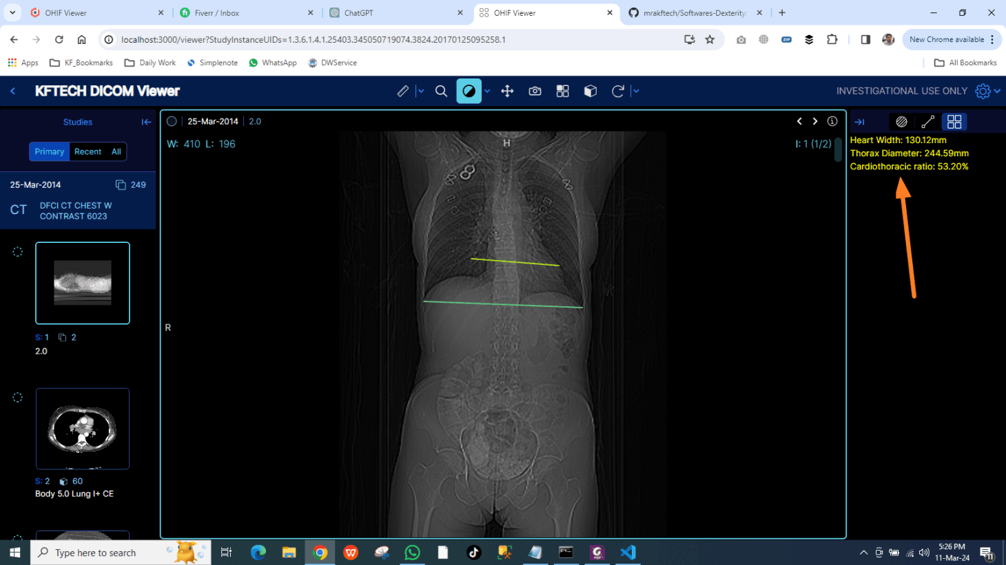 kftech dicom viewer ohif