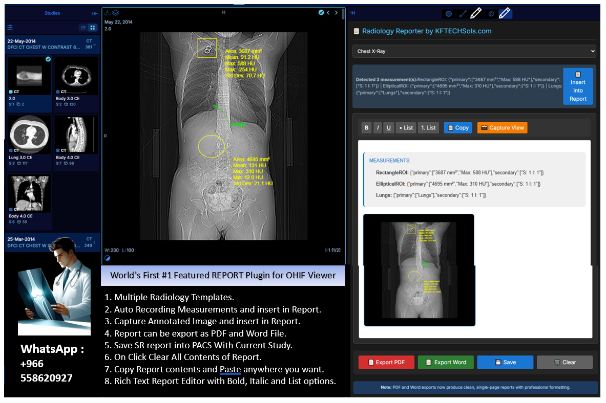 kftech dicom viewer ohif